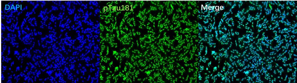  p-tau181 IMMUNOFLUORESCENCE