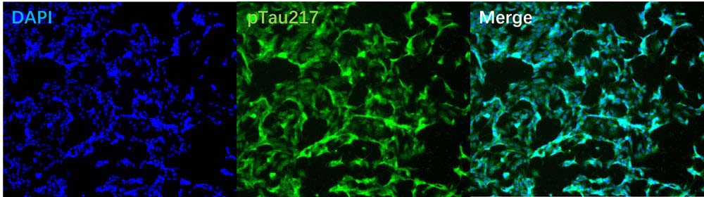  p-tau217 IMMUNOFLUORESCENCE