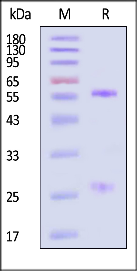 AAV5 SDS-PAGE