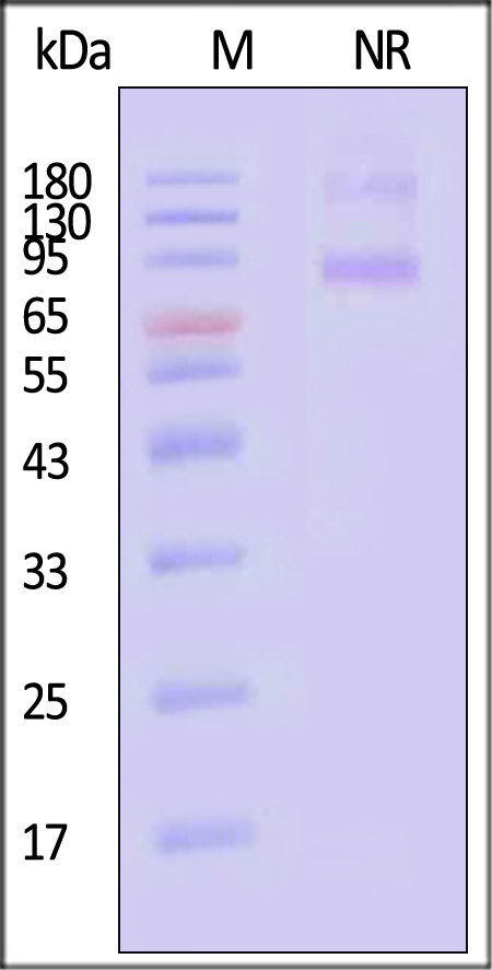 Activin RIB & Activin RIIB SDS-PAGE