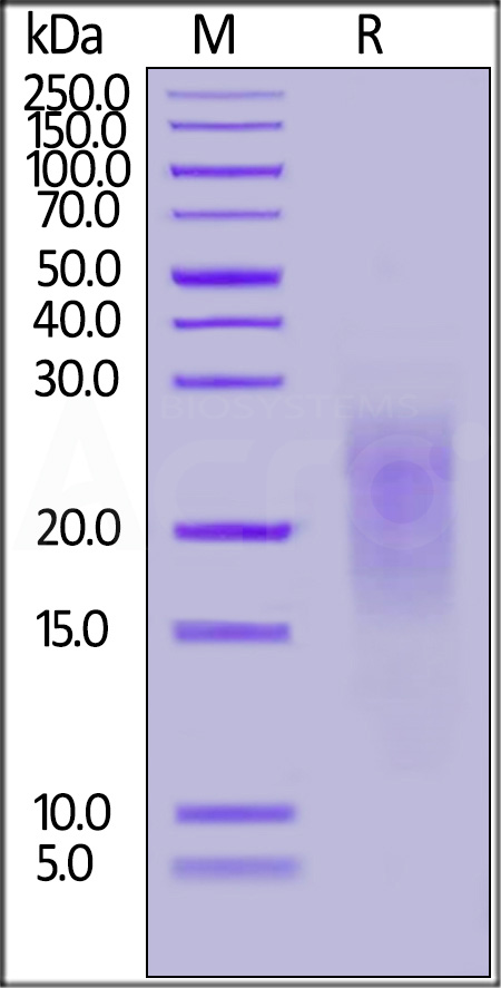 Human ALK-7, His Tag (Cat. No. AL7-H52H5) SDS-PAGE gel