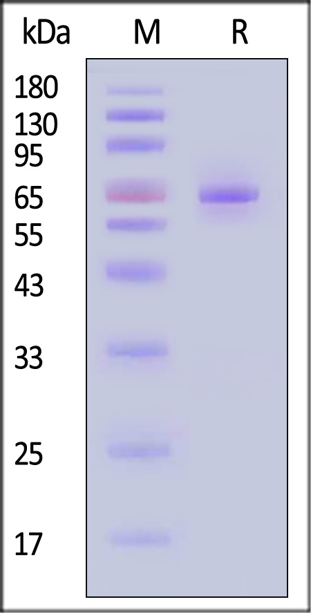 ALPP SDS-PAGE