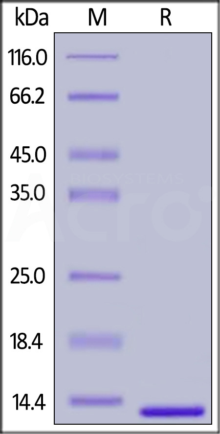 Human B2M, His Tag (Cat. No. B2M-H5225) SDS-PAGE gel