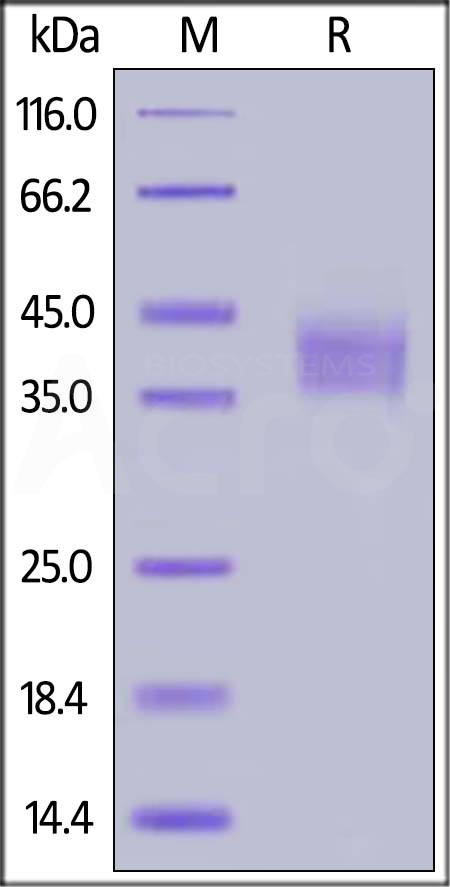 B7-H3 (2Ig) SDS-PAGE