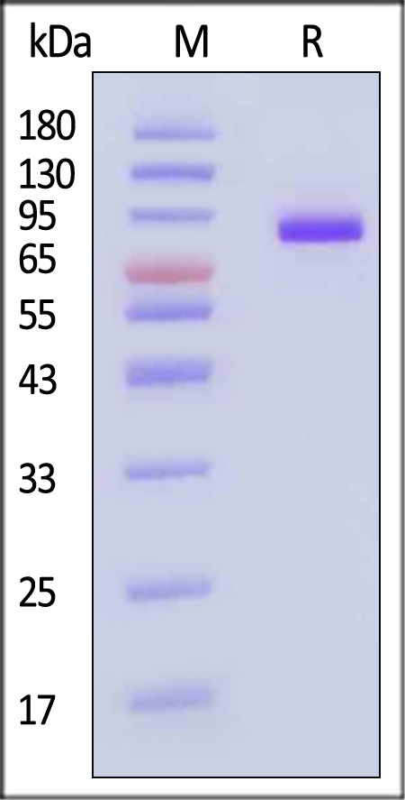 beta-Galactosidase-1 SDS-PAGE