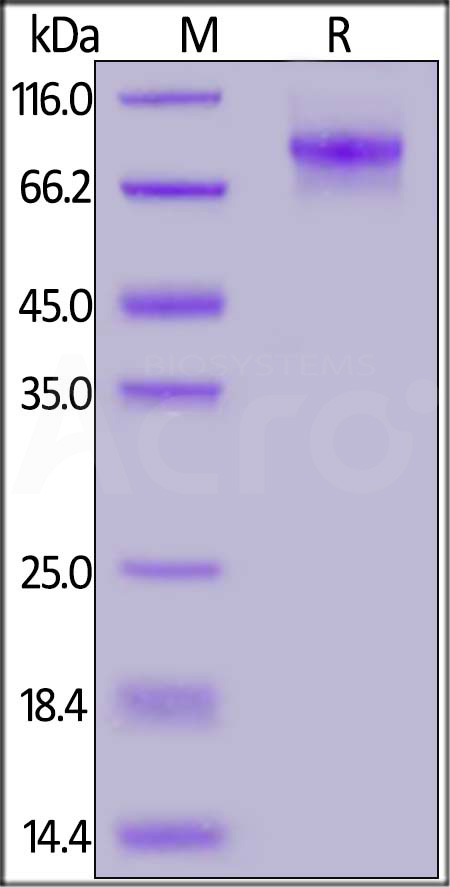 C1q R1 SDS-PAGE