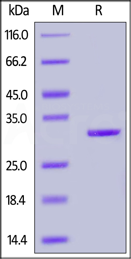 Carbonic Anhydrase II SDS-PAGE