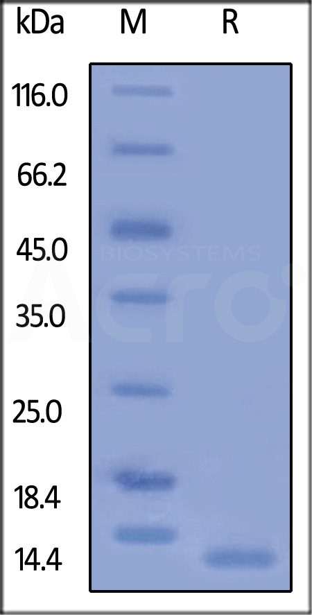 Human CD9, His Tag (Cat. No. CD9-H5220) SDS-PAGE gel