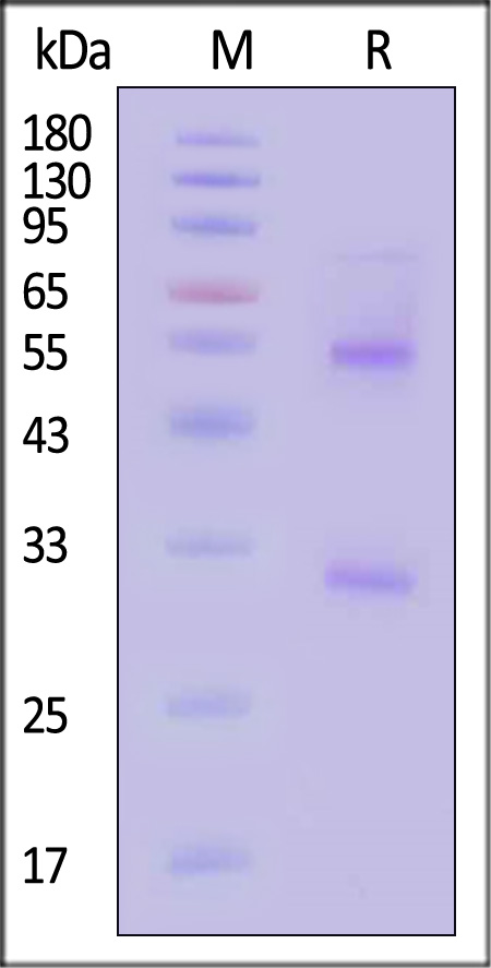 Complement C1s SDS-PAGE