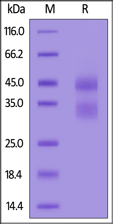 Cathepsin B SDS-PAGE