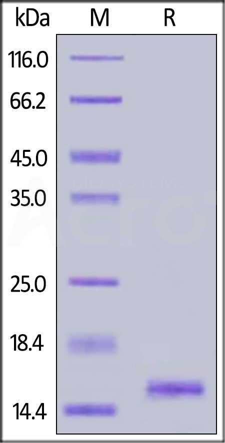 Human FABP1, His Tag (Cat. No. FA1-H5148) SDS-PAGE gel