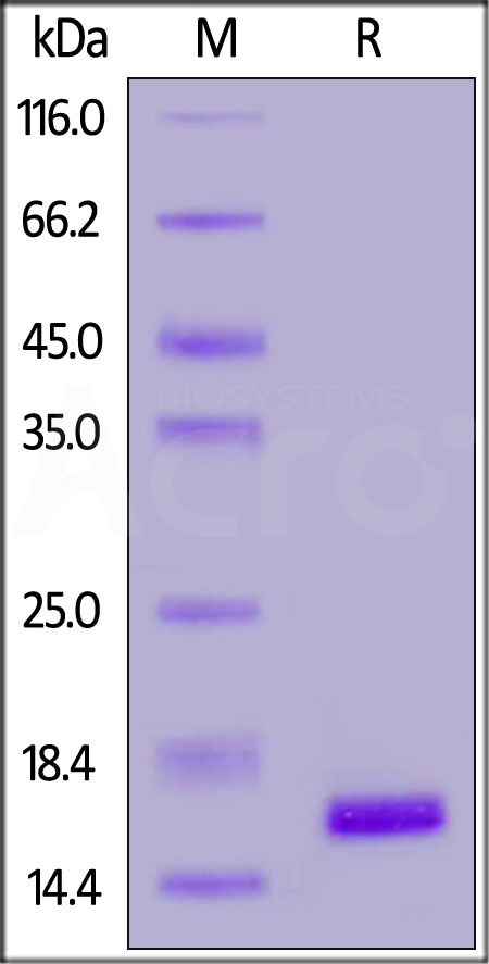 Human FABP3, His Tag (Cat. No. FA3-H5128) SDS-PAGE gel