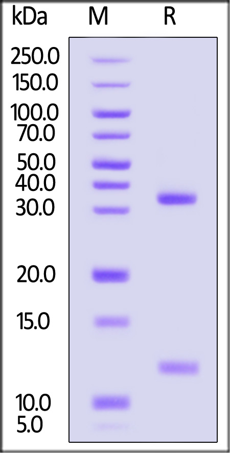 FcRn (FCGRT & B2M) SDS-PAGE