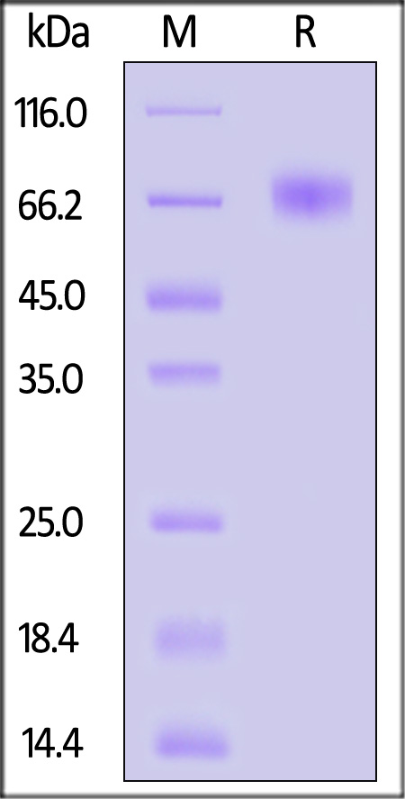 Coagulation factor IX SDS-PAGE