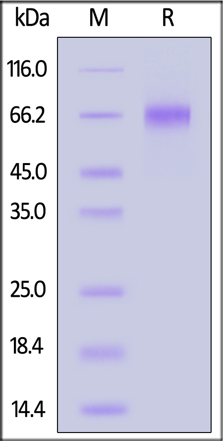 Coagulation factor IX SDS-PAGE