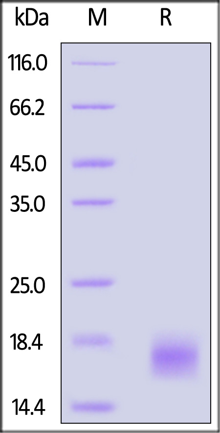 Cholera enterotoxin subunit B SDS-PAGE