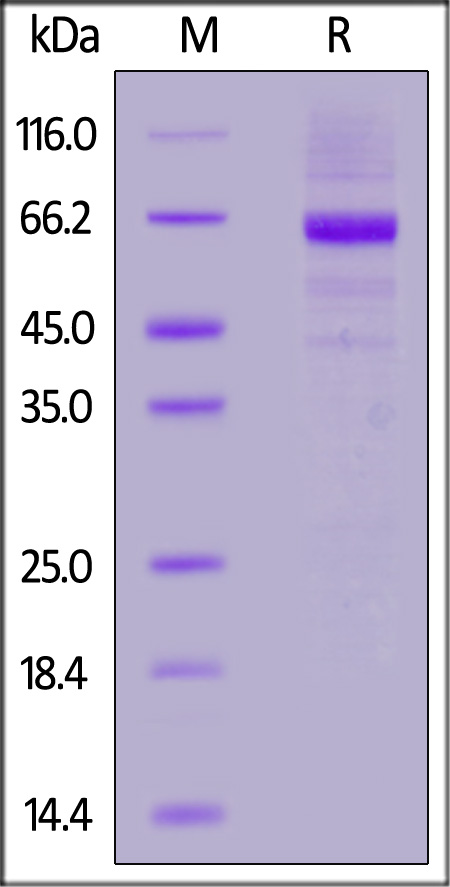 Glucosylceramidase SDS-PAGE