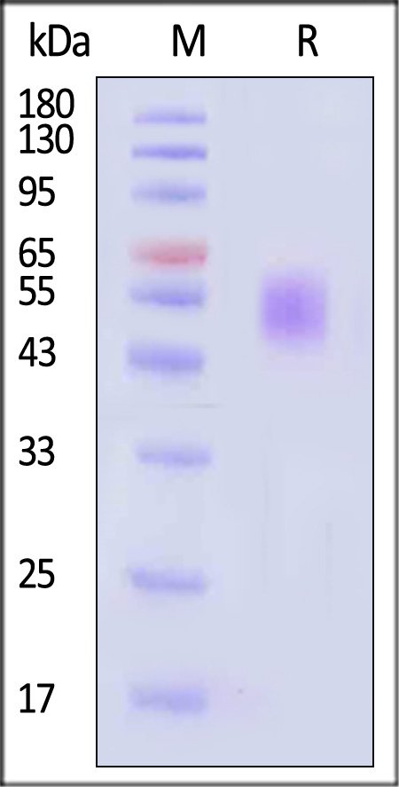 GM-CSF R alpha SDS-PAGE