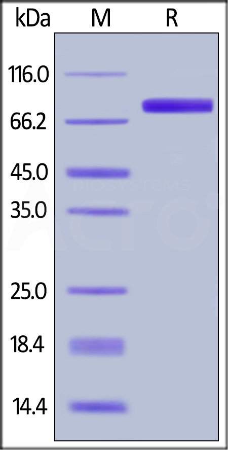 GM-CSF R alpha SDS-PAGE