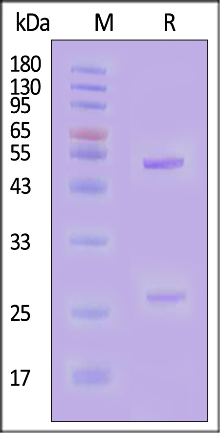 Hemagglutinin 1/HA 1 (Influenza Virus) SDS-PAGE