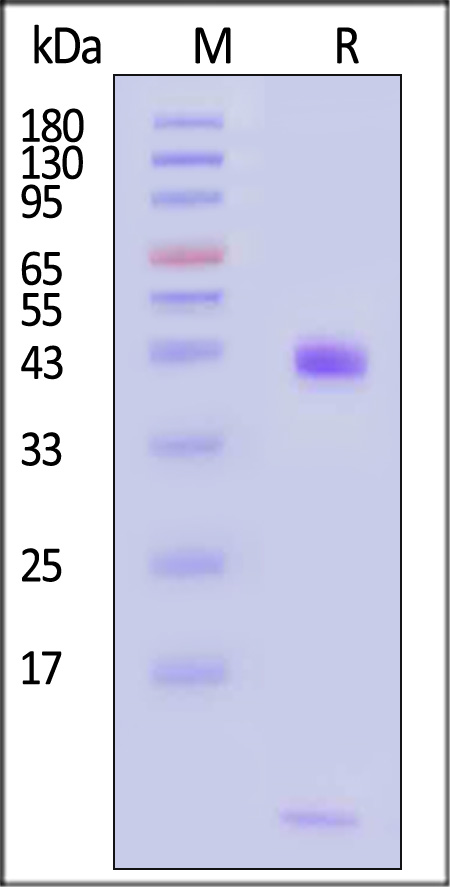 HLA-A*1101 & B2M & HPV16-E7 (IVCPICSQK) SDS-PAGE