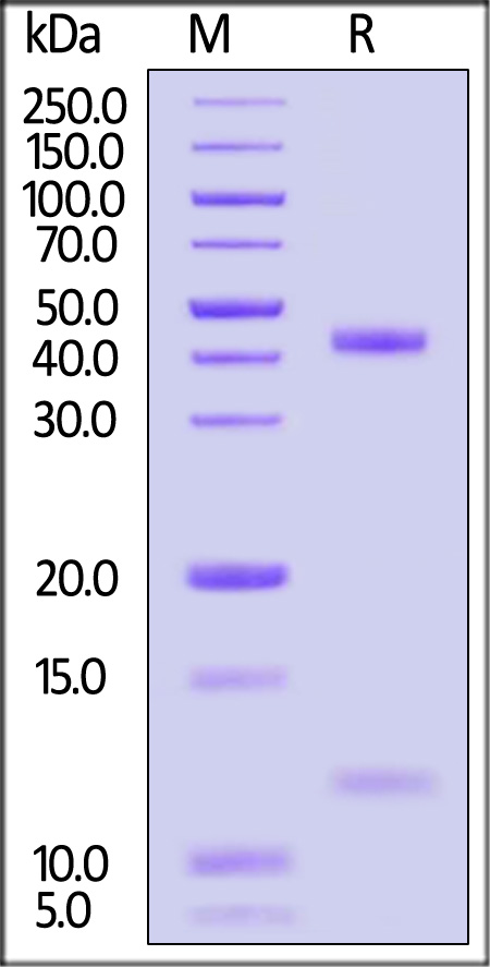 HLA-A*0301 & B2M & KRASG12C (VVGACGVGK) SDS-PAGE