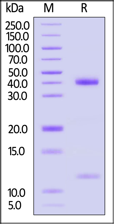 HLA-A*1101 | B2M | KRASG12D (VVGADGVGK) SDS-PAGE