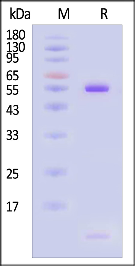 HLA-A*0201 & B2M & PRAME (SLLQHLIGL) SDS-PAGE