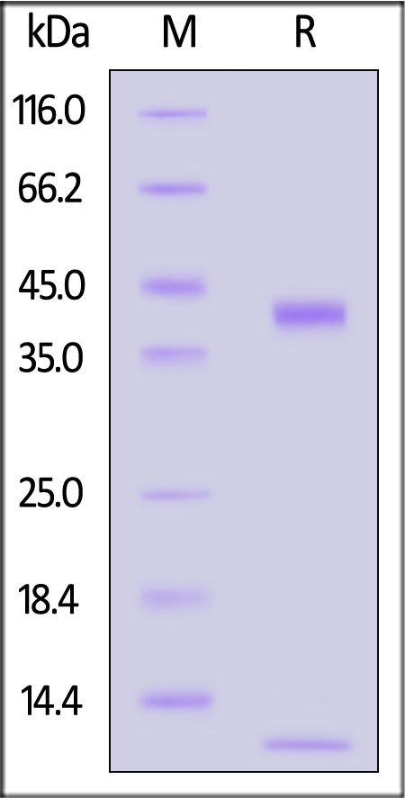 HLA-A*0201 | B2M | EW SDS-PAGE