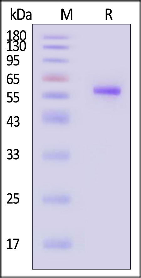 HLA-A*0201 & B2M & PRAME (SLLQHLIGL) SDS-PAGE