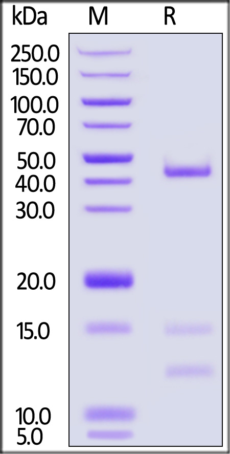 HLA-A*02:01 & B2M & MAGE-A4 (KVLEHVVRV) SDS-PAGE