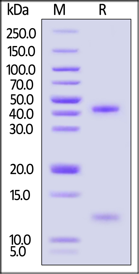 HLA-A*0201 | B2M | MAGE-A4 SDS-PAGE