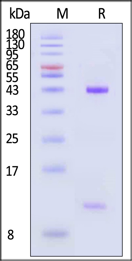 HLA-A*0201 | B2M | MAGE-A1 SDS-PAGE