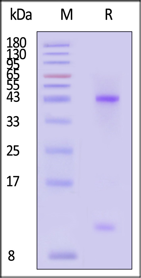 HLA-A*0201 | B2M | MAGE-A4 SDS-PAGE