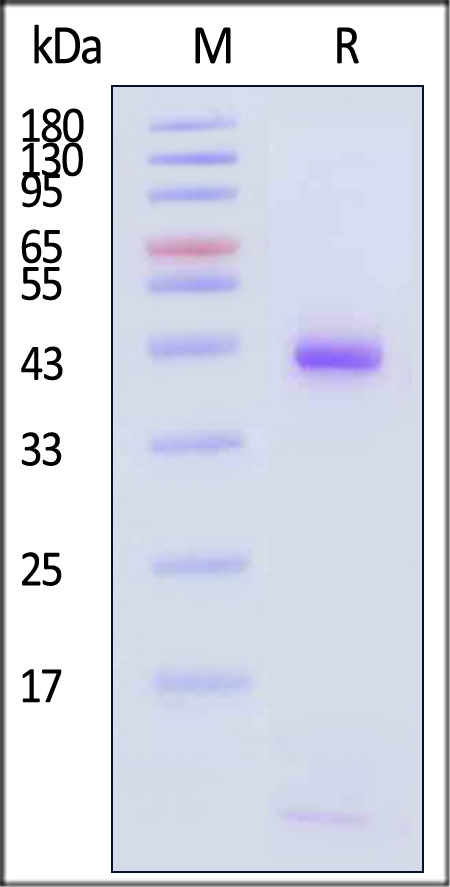 HLA-B*0702 & B2M SDS-PAGE