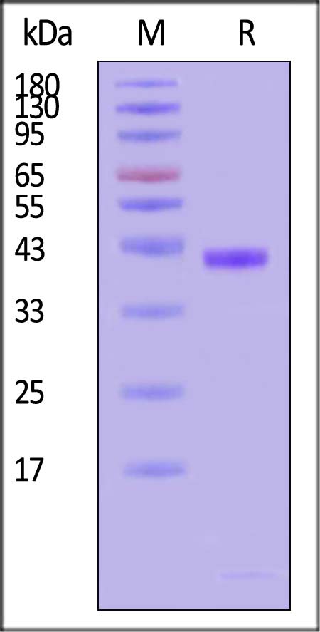 HLA-A*02:01 & B2M SDS-PAGE