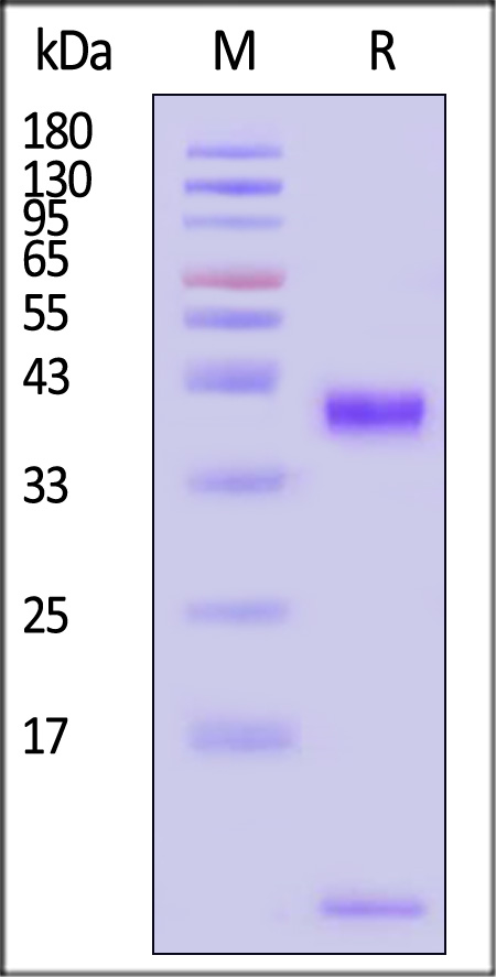 HLA-A*0201 | B2M | p53 (RMPEAAPPV) SDS-PAGE