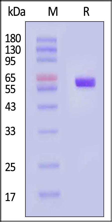 HLA-A*0201 & B2M & p53 (HMTEVVRHC) SDS-PAGE