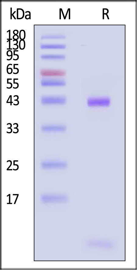 HLA-A*0201 & B2M & Vaccinia virus (ILYDNVVTL) SDS-PAGE