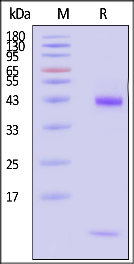 HLA-A*1101 & B2M & KRAS (VVVGAGGVGK) SDS-PAGE