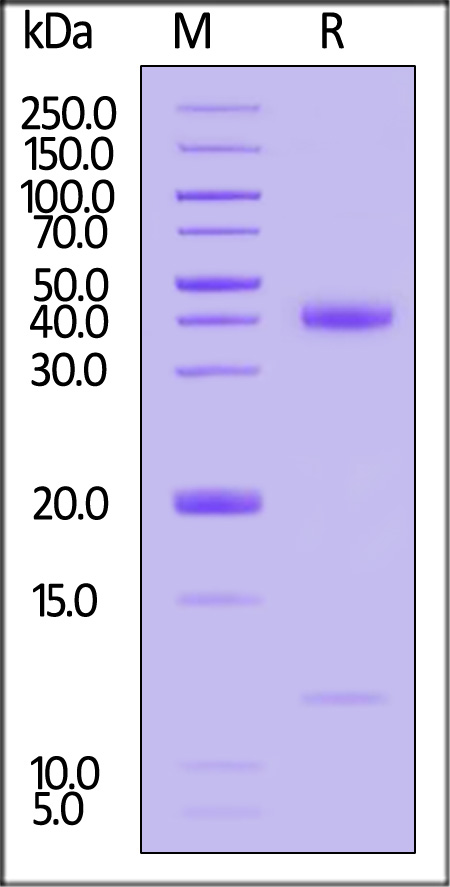 HLA-A*1101 | B2M | KRAS (VVGAGGVGK) SDS-PAGE