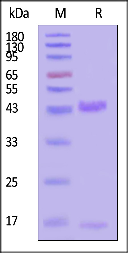 HLA-A*0301 & B2M & KRAS (VVVGAGGVGK) SDS-PAGE