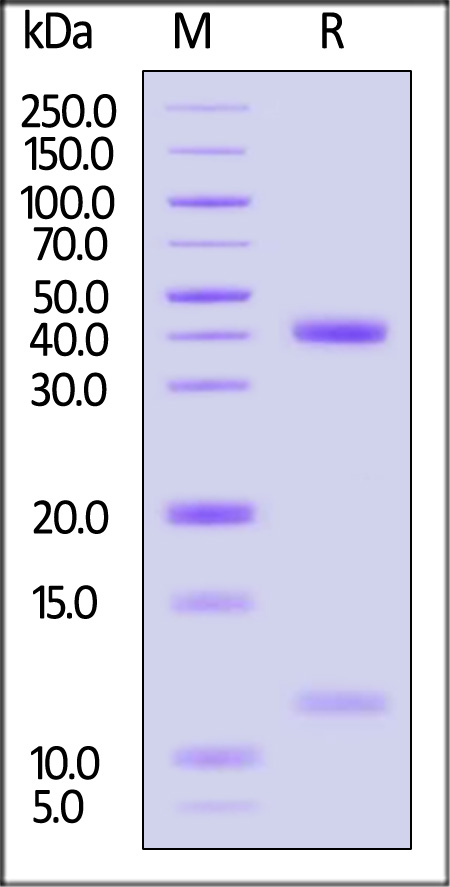 HLA-A*1101 | B2M | KRAS (VVGAGGVGK) SDS-PAGE