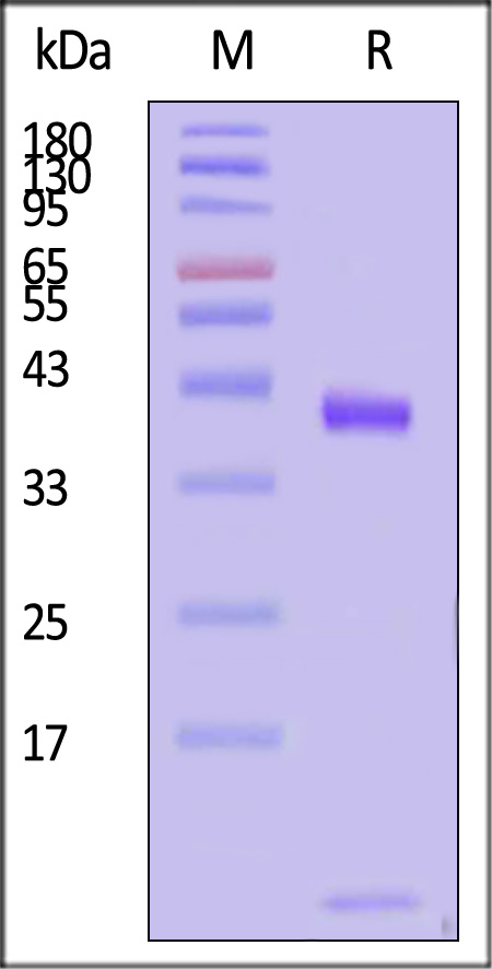 HLA-A*1101 & B2M & KRASG12S (VVVGASGVGK) SDS-PAGE