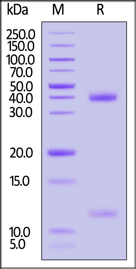 HLA-A*1101 | B2M | KRASG12V (VVGAVGVGK) SDS-PAGE