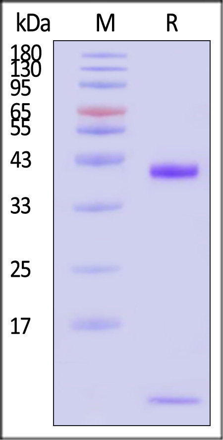 HLA-A*0201 & B2M & KRASG12V (VVVGAVGVGK) SDS-PAGE