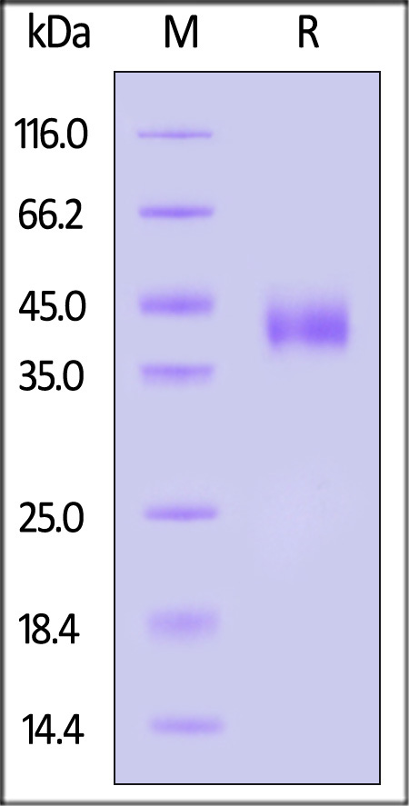 Human IL-28 R alpha, His Tag (Cat. No. ILR-H52H9) SDS-PAGE gel