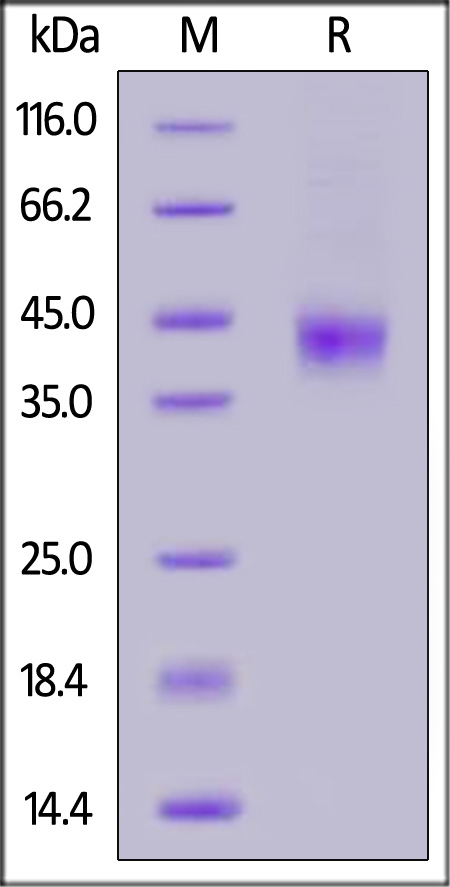 MASP3 SDS-PAGE