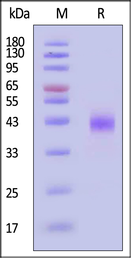 MASP3 SDS-PAGE