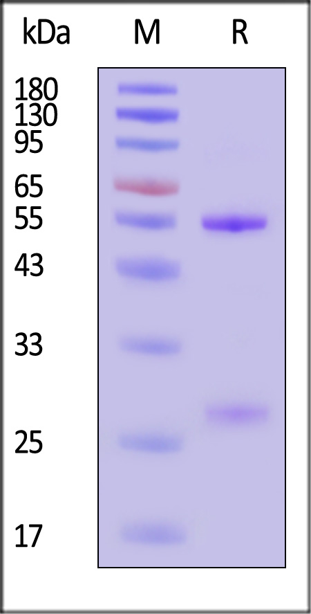 Postfusion glycoprotein F0/post-F protein (NiV) SDS-PAGE